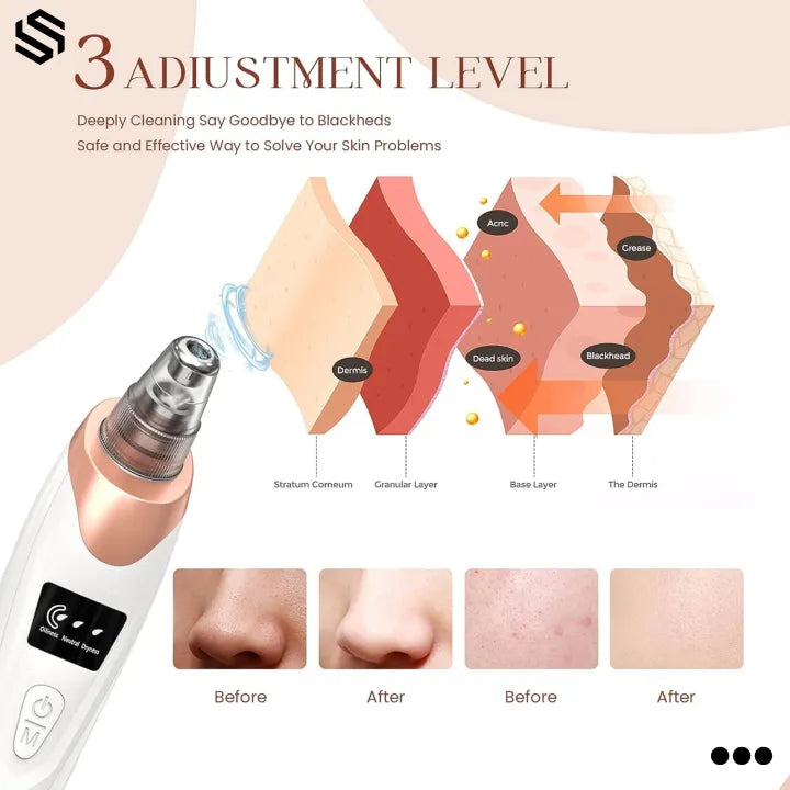 Blackhead Remover π€with Deep Pore Cleaning